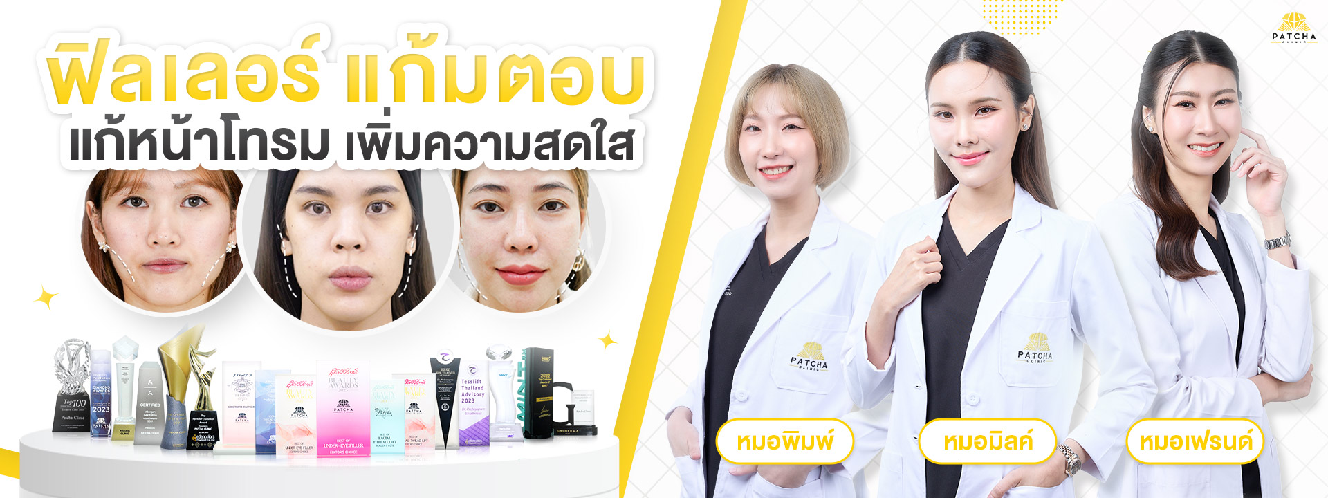 ฟิลเลอร์แก้มตอบ