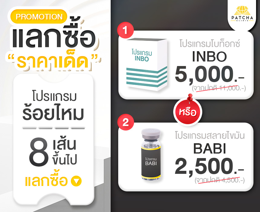 แบรนเนอร์แลกซื้อMB