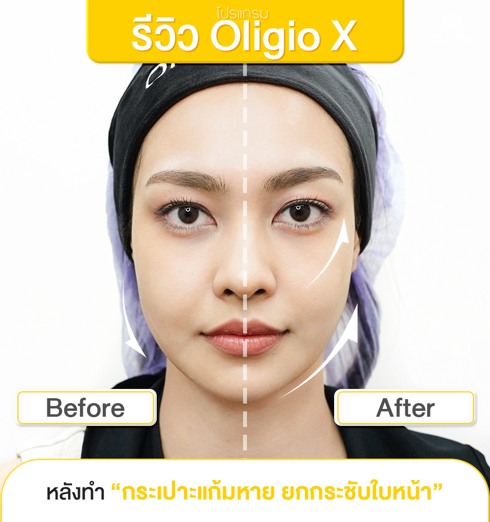 รีวิว Oligio X
