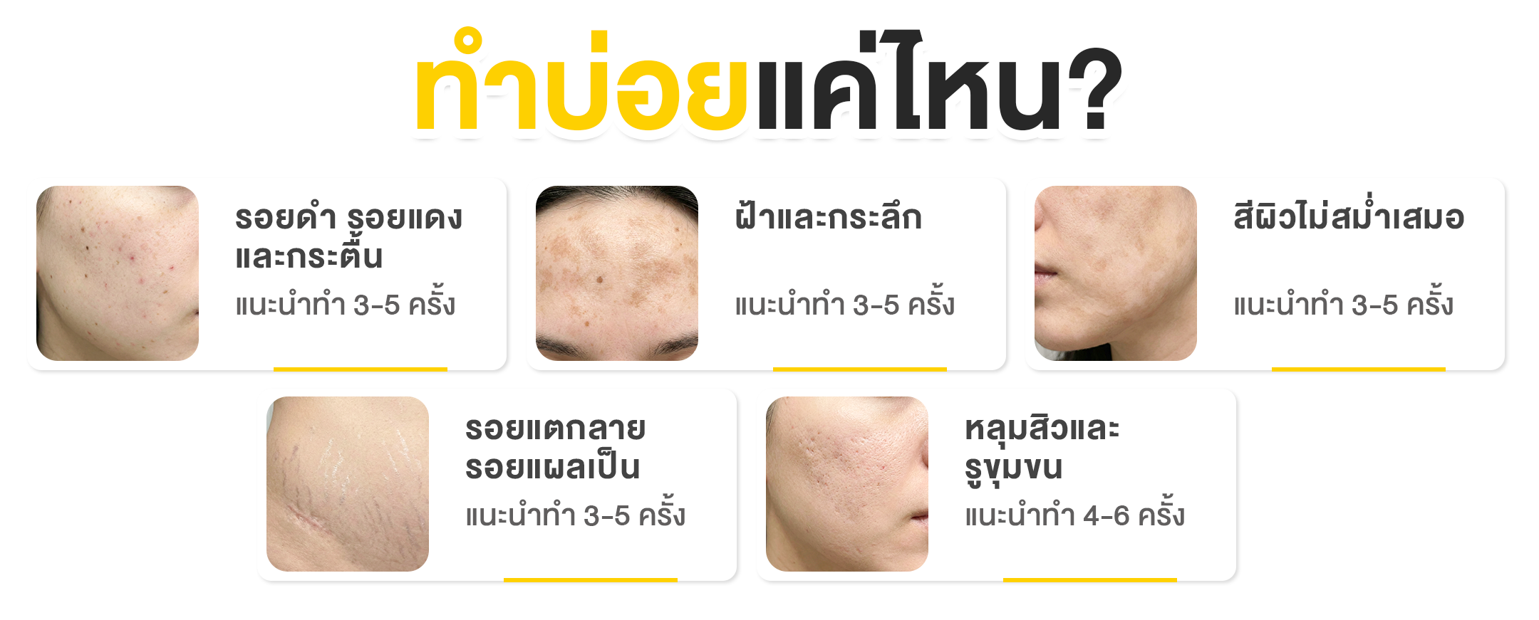 Pico Laser ทำบ่อยแค่ไหน