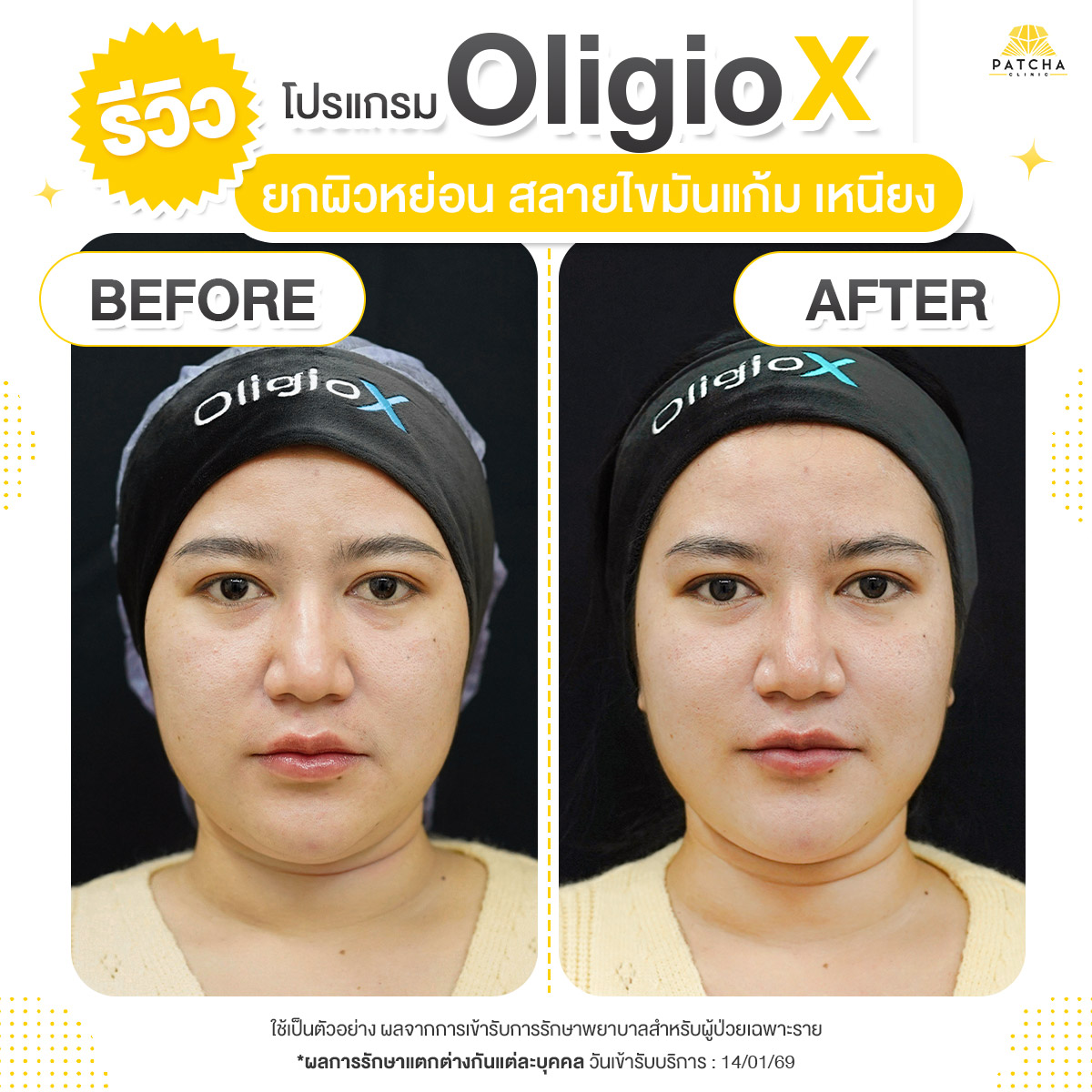 รีวิวOligio X