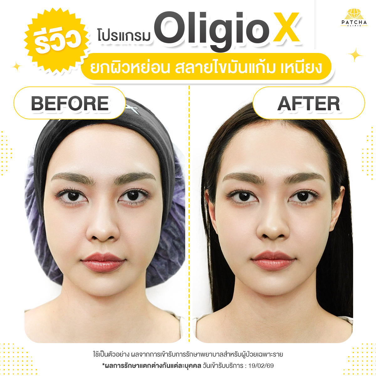 รีวิวOligio X